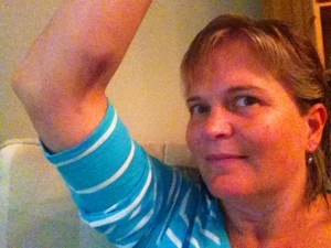 Bruising from her blood work. Each time she has blood work done, they take 11 vials of blood.